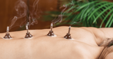 Acupuncture et la moxibustion sont des thérapies alternatives traditionnelles de médecine chinoise