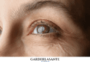 cataracte